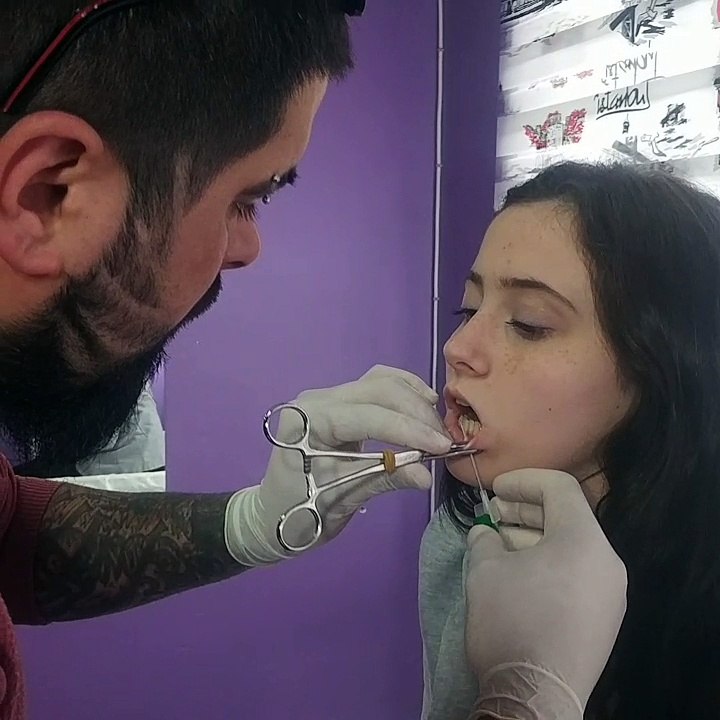 Dudak Delme işlemi Sakarya Adapazarı Barış Yüksek #sakarya #adapazarı #serdıvan #serdıvanpirsing #dudakdelme #saü #myo #kyka #mavidurak #çarkcaddesi #Piercing #kbbdelimi #Lip #piercing @sakaryadovmeci @barış @yüksek