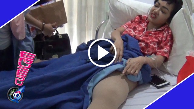 Kaki Bengkak, Jupe Ubah Mindset - Cumicam 12 Maret 2017