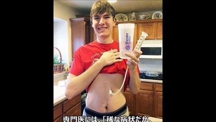 【奇病・難病】全ての食べ物にアレルギー反応を起こす少年の言葉が凄い