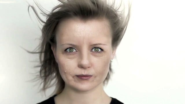 Botox & Dermal Fillers - What Are You Waiting For?