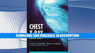 Best Seller Book Chest X-Ray Made Easy, 1e By Jonathan Corne MA  PhD  MB BS  FRCP