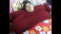 La femme la plus grosse du monde a perdu 100 kilos après une opération chirurgicale associée à un régime