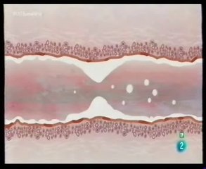 De las grasas saturadas a las hidrogenadas: Cardiopatias
