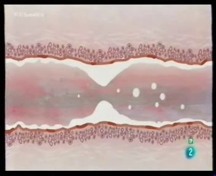 De las grasas saturadas a las hidrogenadas: Cardiopatias