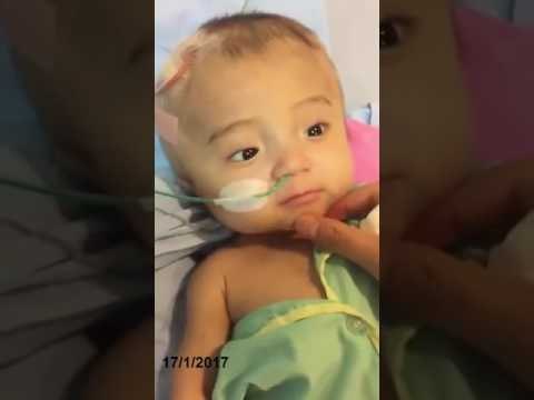 Bé Phạm Đức Lộc chùa Vạn Đức Điều trị tại Singapore Ngày 17 01 2017