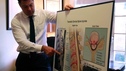 Brian White - Houston Personal Injury Attorney