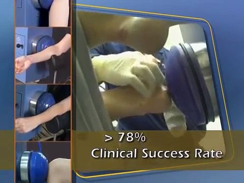 Orthotics For Heel Pain