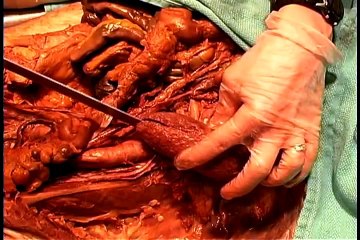 Anatomical dissection  8  Ab. autonomics, genital & urinary s., diaphragm, p.a. wall.