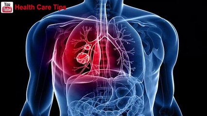 7 Common Things In Your House That Can Damage Your Lungs!