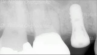 West Frisco Dental And Implants - www.westfriscodental.com - frisco dentist