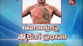 Aarogyamastu _ Smoking Effects on Lungs _ 8th March 2017 _ ఆరోగ్యమస్త�