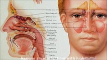 Remove sinus infections with high-frequency sound therapy (4400Hz)