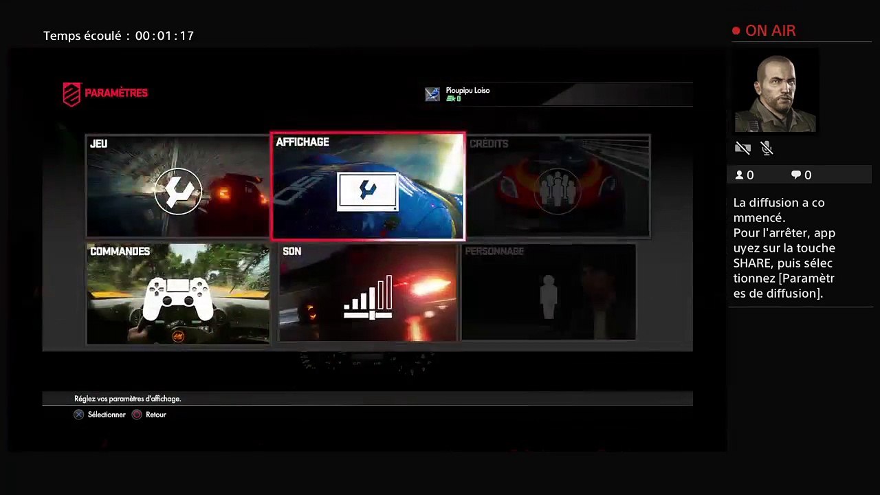 Diffusion PS4 en direct de ruidant5 (4)