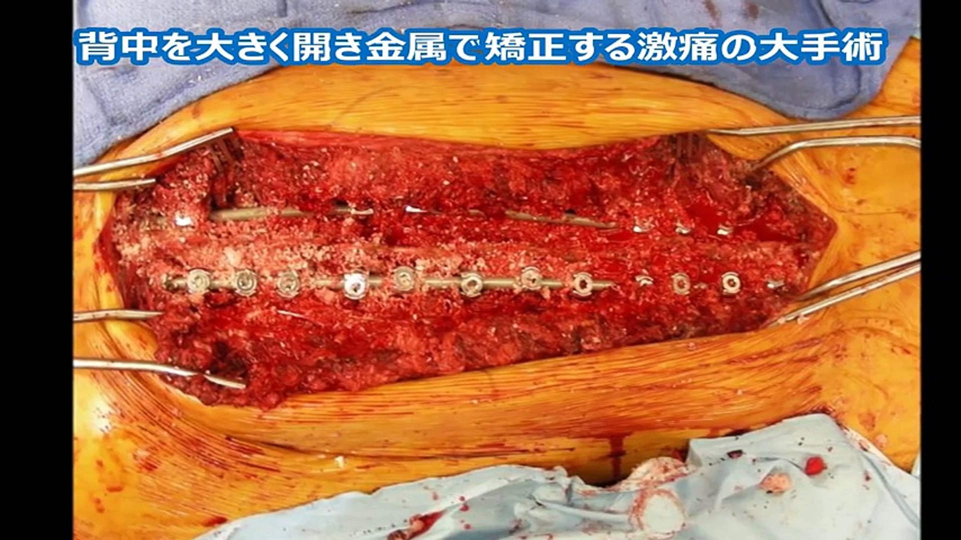 閲覧注意 グロ注意 美女のアソコがヤバイ 世界が震えた Video Dailymotion