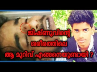 ജിഷ്ണുവിന്റെ പോസ്റ്റ്‌മോര്‍ട്ടം റിപ്പോര്‍ട്ട് | Oneindia Malayalam