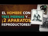 El hombre con tres piernas y... ¡2 aparatos reproductores!