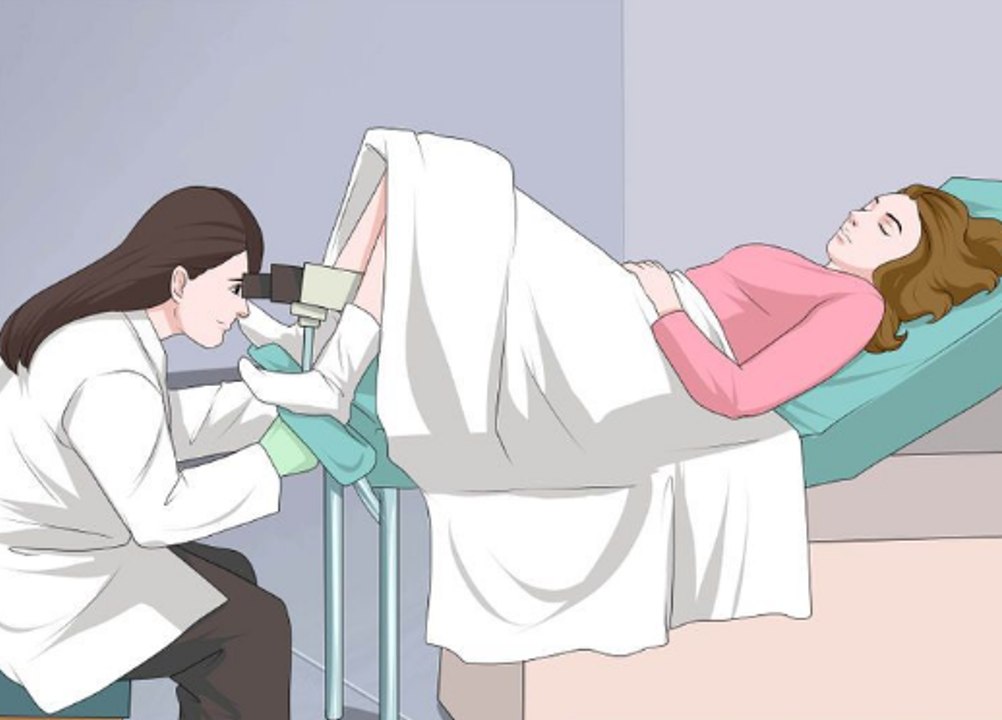 Pap Smear - How To Prepare For A Pap Smear Exam - video Dailymotion
