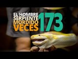 El hombre SERPIENTE, mordido 173 veces