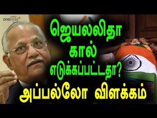 ஜெயலலிதா கால் எடுக்கப்பட்ட விவகாரம்  | I am ready to enquiry says 'Prathap reddy'- Oneindia Tamil