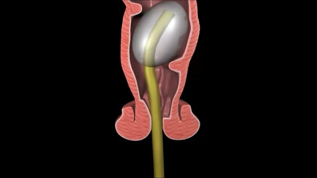 Anorectal manometry