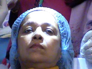 Dr Haroon Nabi  PAD Work Shop on BOTOX and FILLER At Nishter Hospital