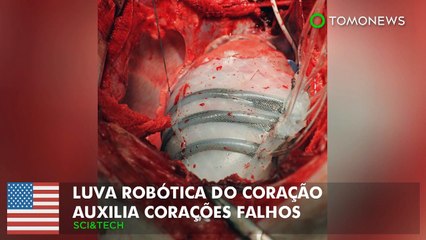 Luva robótica do coração auxilia corações falhos.