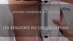 Les résultats du COOLSCULPTING sur l'intérieur des cuisses - Centre Marceau Paris