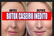 (BOTOX CASEIRO) Como acabar com as RUGAS em poucos dias com essa RECEITA POWER por Nina Della Rosa