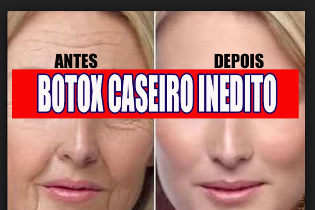 (BOTOX CASEIRO) Como acabar com as RUGAS em poucos dias com essa RECEITA POWER por Nina Della Rosa