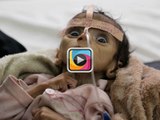 Unicef'in açıklamasına göre Sunni - Şii savaşı sonucu 1,5 milyon çocuk açlıktan ölecek!