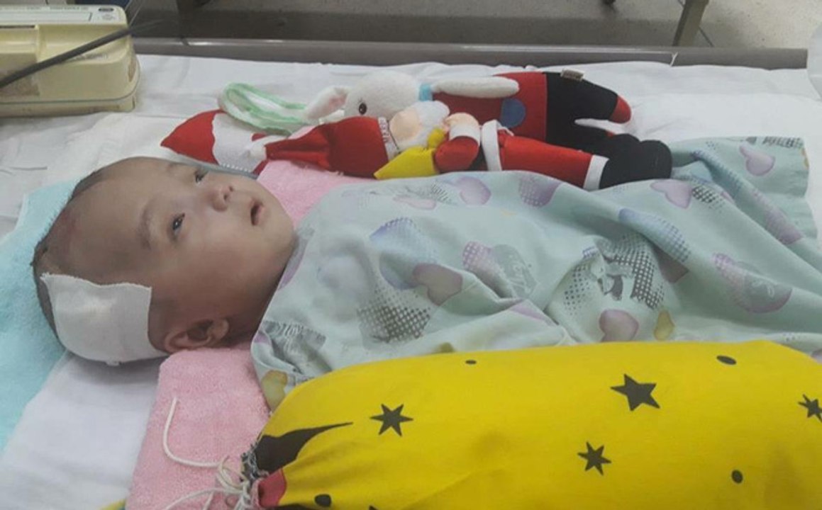 Rớt nước mắt hình ảnh cậu bé bị não úng thủy Đức Lộc bị bỏ rơi khi mới lọt lòng