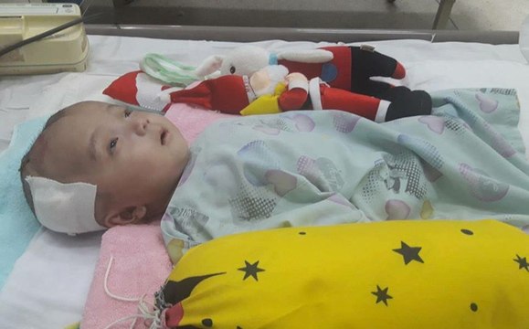 Rớt nước mắt hình ảnh cậu bé bị não úng thủy Đức Lộc bị bỏ rơi khi mới lọt lòng