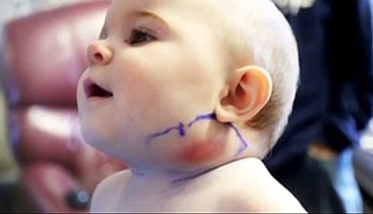 Baby appeared open on neck