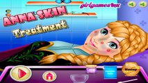 [♥ Frozen] Frozen Songs Frozen Elsa Princess Anna Rapunzel Accident Skin Doctor