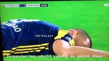 Fernando Horribly Breaks His Hand vs Konyaspor!