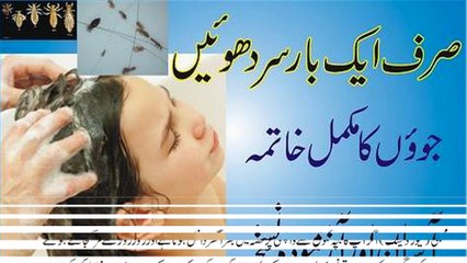Homemade remedies to remove Lice from hair easily in urdu