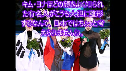 キムヨナが顔面整形で超美人モデルに大変貌！驚愕の最終形態・・・！