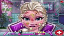 Elsa Skin Doctor: Disney princess Frozen Elsa - Best Baby Games For Kids