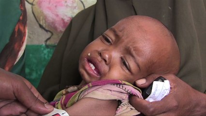 Somalie: la sécheresse et la famine frappent à nouveau