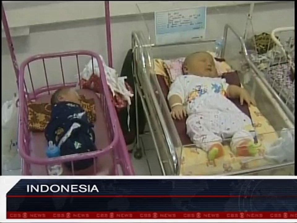 Mama je rodila trojke, ali jedna beba se potpuno razlikovala od ostalih! Liječnici nikada nisu vidjeli nešto slično!
