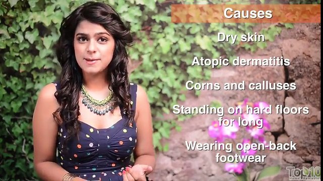 Natural Alternative Cures for Cracked Heels - Cure Cracked Feet Fast