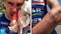 Agression présumée du cycliste Yoann Offredo : deux versions s'affrontent