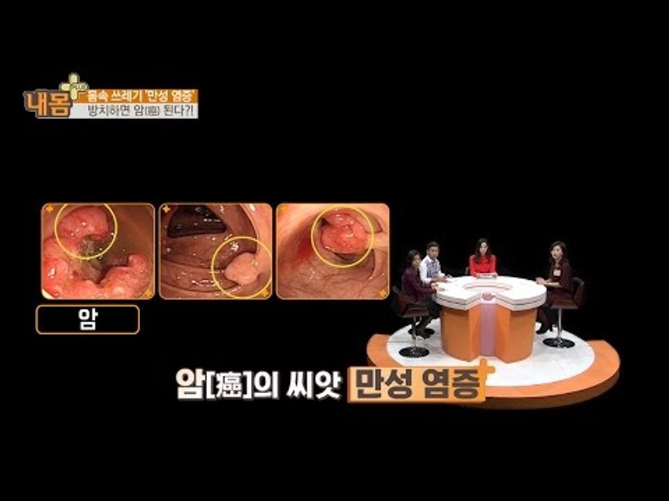 방치하면 암이 되는 만성 염증! [내 몸 플러스] 31회 20161106