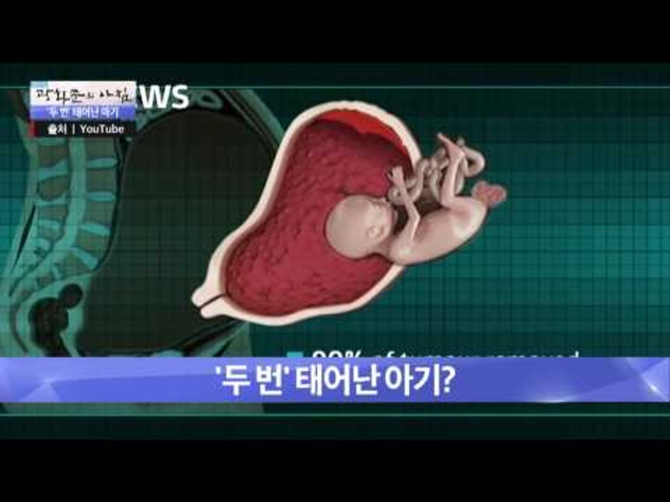 기적 같은 이야기 ‘두 번’ 태어난 아기! [광화문의 아침] 350회 20161103