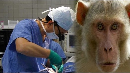 Monkey head transplant done first time in history, surgeon claims