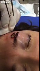 Genç Kızın Kafasından Çıkan Şeye İnanamayacaksınız!