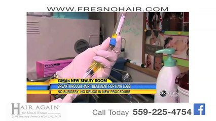 PRP- Platelet Rich Plasma Therapy in Fresno, California