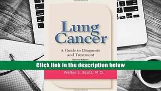 PDF  Lung Cancer: A Guide to Diagnosis and Treatment Trial Ebook