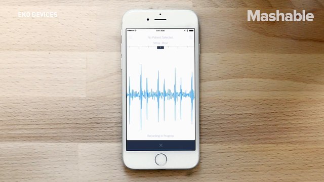 The stethoscope finally got a long-awaited upgrade