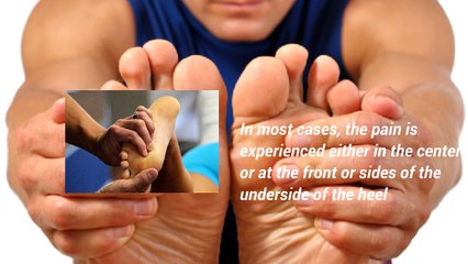 Know About How To Cure Plantar Fasciitis